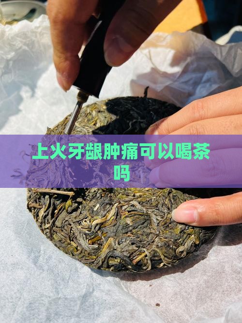 上火牙龈肿痛可以喝茶吗