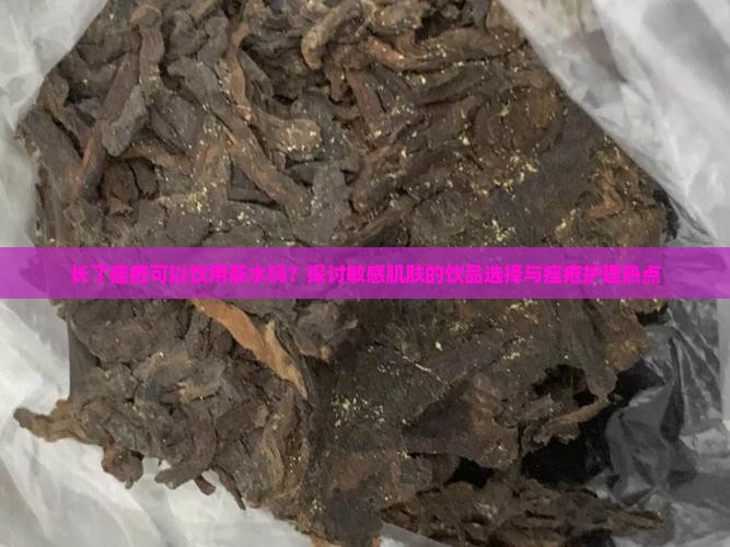长了痤疮可以饮用茶水吗？探讨敏感肌肤的饮品选择与痤疮护理热点