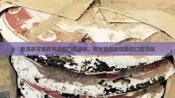 普洱茶可能有效缓解口腔溃疡，常饮普洱或可助愈口腔溃疡