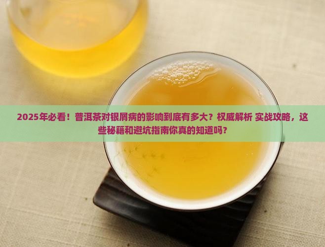 普洱茶对银屑病有什么影响
