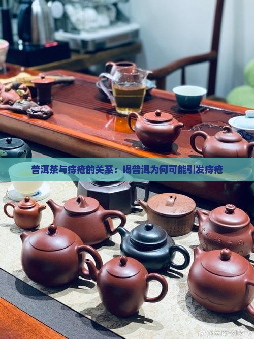 喝陈皮普洱茶长痔疮