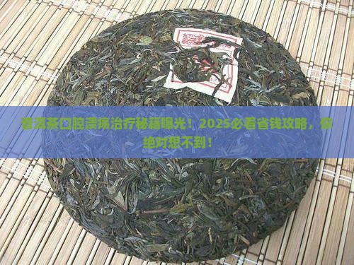普洱茶口腔溃疡治疗