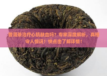 普洱茶治疗心肌缺血吗