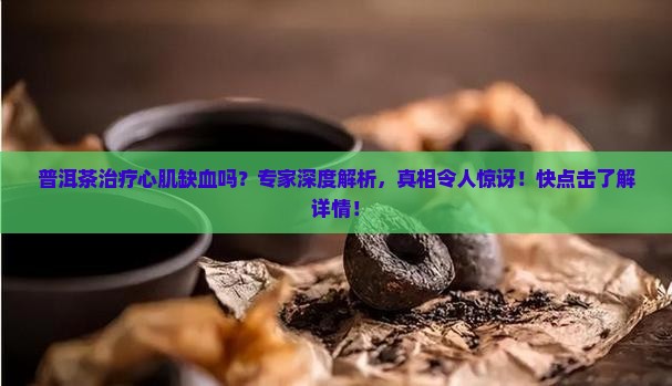 普洱茶治疗心肌缺血吗