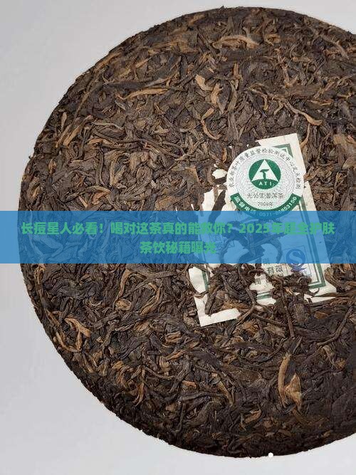 长痤疮喝什么茶比较好