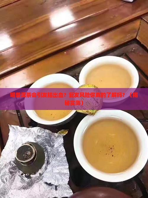 喝普洱茶导致脑出血吗会复发吗