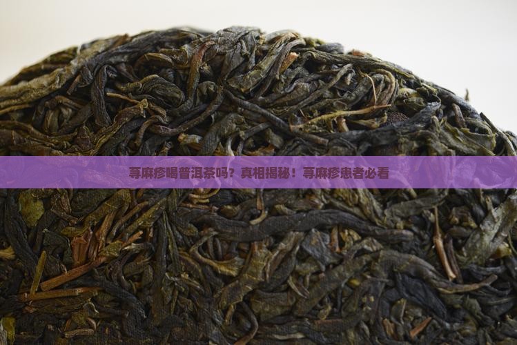 荨麻疹喝普洱茶吗
