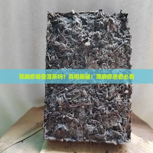 荨麻疹喝普洱茶吗