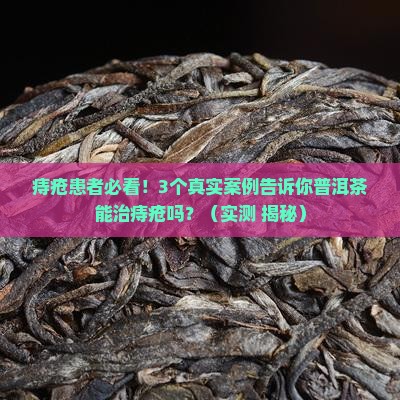 普洱茶可以治疗痔疮吗