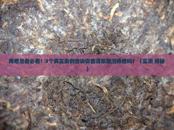 普洱茶可以治疗痔疮吗