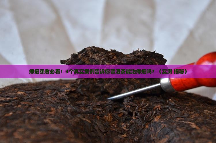 普洱茶可以治疗痔疮吗