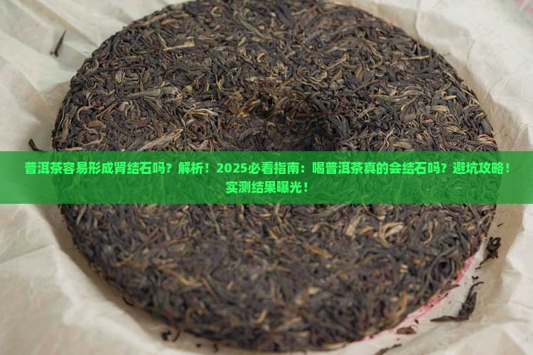 普洱茶容易形成肾结石吗