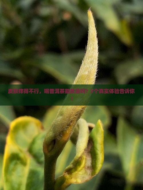 皮炎喝普洱茶有用吗