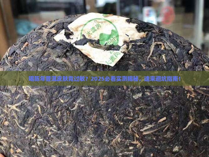 喝陈年普洱茶皮肤过敏