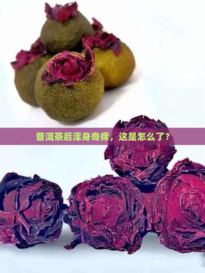 吃了普洱茶身上痒