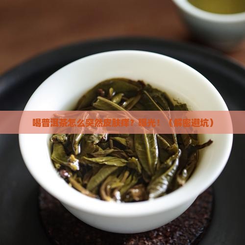 喝普洱茶的皮肤痒怎么回事