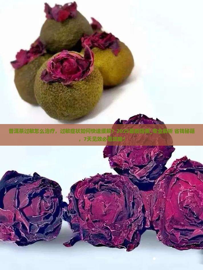 普洱茶过敏怎么治疗