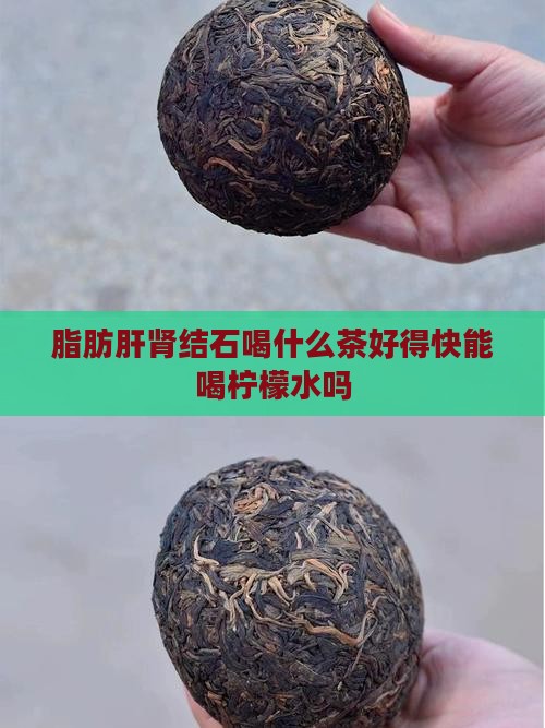 脂肪肝肾结石喝什么茶好