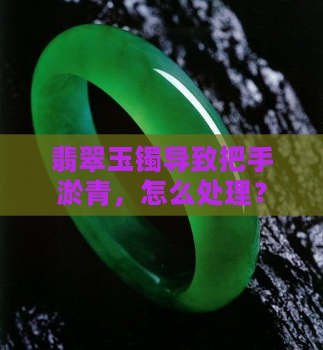 翡翠玉镯导致把手淤青，怎么处理？