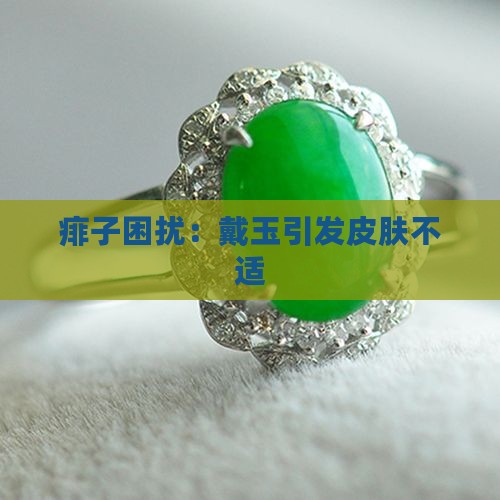 痱子困扰：戴玉引发皮肤不适