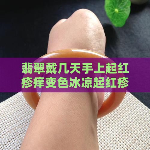 翡翠戴几天手上起红疹痒变色冰凉起红疹