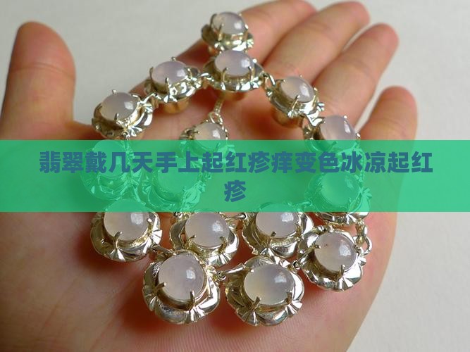 翡翠戴几天手上起红疹痒变色冰凉起红疹