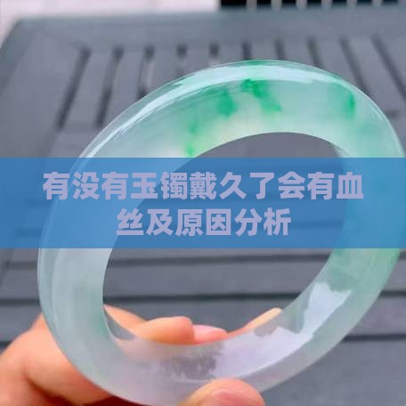 有没有玉镯戴久了会有血丝及原因分析