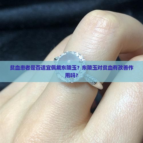 贫血患者是否适宜佩戴东陵玉？东陵玉对贫血有改善作用吗？
