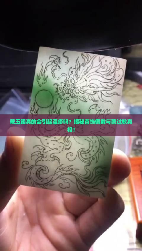 戴玉镯真的会引起湿疹吗？揭秘首饰佩戴与剪过敏真相！