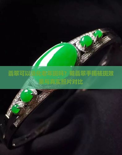 翡翠可以淡化老年斑吗？戴翡翠手镯祛斑效果与真实照片对比